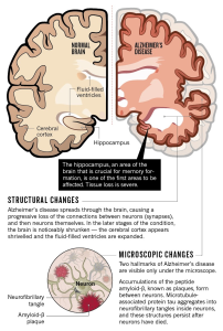 Age-Related Brain Diseases: 17 Risk Factors to Address