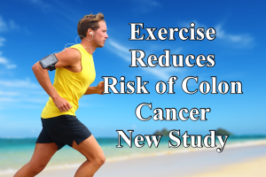 Exercise and Colon Cancer: Boosting Survival Rates Post-Treatment