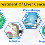 Liver Cancer Treatment: Understanding Bile Imbalance