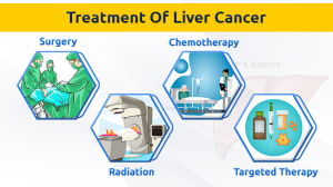 Liver Cancer Treatment: Understanding Bile Imbalance